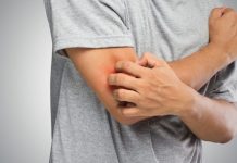 10 situações em que nunca deve coçar-se