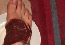 Futebolista engana-se no número do fisioterapeuta e acaba com um bife no pé