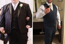 7 “Antes e Depois” que mais surpreenderam o mundo