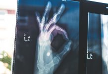 Os exames que podem mesmo salvar-lhe a vida