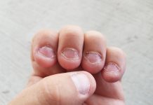 O vício de roer as unhas pode matá-lo